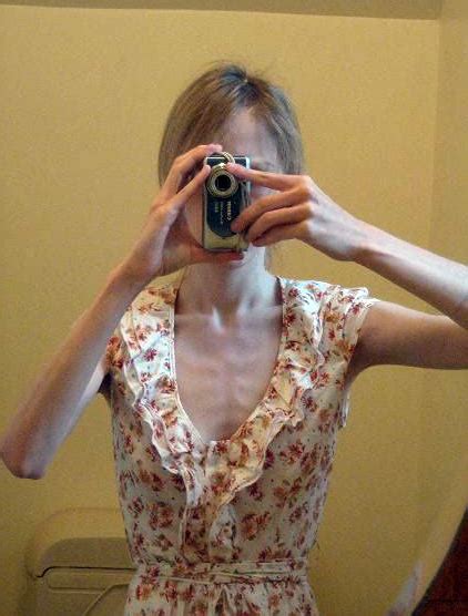 anorexic porn|anorexic Search